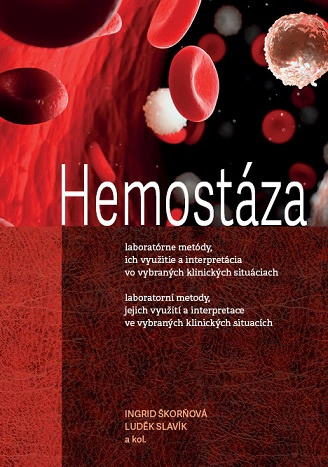 Hemostáza, laboratorní metody, jejich využití a interpretace ve vybraných klinických situacích Univerzita Palackého v Olomouci Hemostáza, laboratorní metody, jejich využití a interpretace ve vybraných klinických situacích Univerzita Palackého v Olomouci