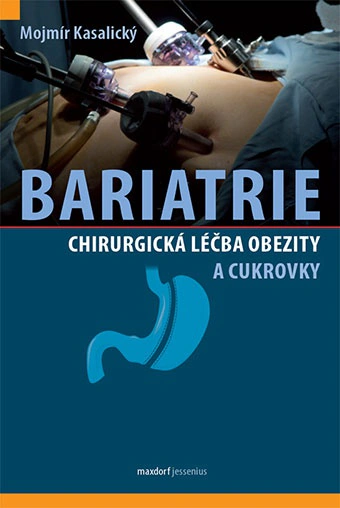 Bariatrie - Chirurgická léčba obezity a cukrovky Maxdorf Bariatrie - Chirurgická léčba obezity a cukrovky Maxdorf