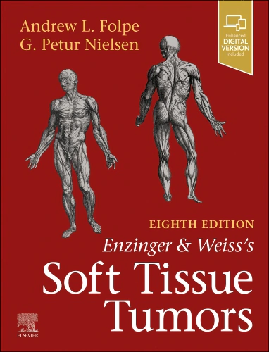 Enzinger and Weiss's Soft Tissue Tumors Elsevier - Health Sciences Division