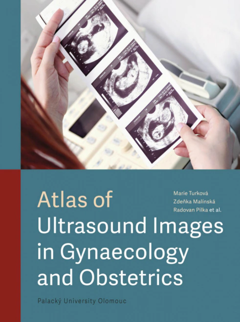 Atlas of Ultrasound Images in Gynaecology and Obstetrics Univerzita Palackého v Olomouci
