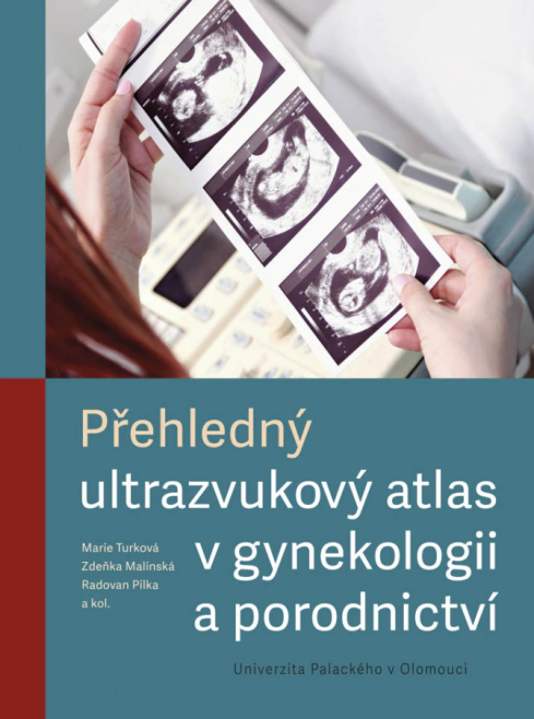 Přehledný ultrazvukový atlas v gynekologii a porodnictví Univerzita Palackého v Olomouci Přehledný ultrazvukový atlas v gynekologii a porodnictví Univerzita Palackého v Olomouci